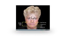 Facial Effects of Tooth Loss video