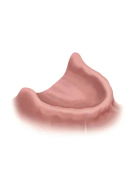 Lower jaw with no teeth