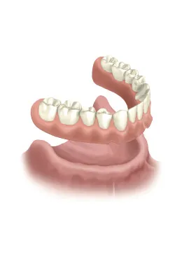 2-DS permanent dentures