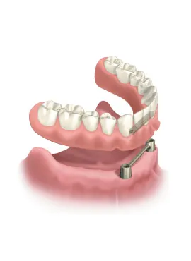 4-DS