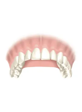 8-DR upper arch