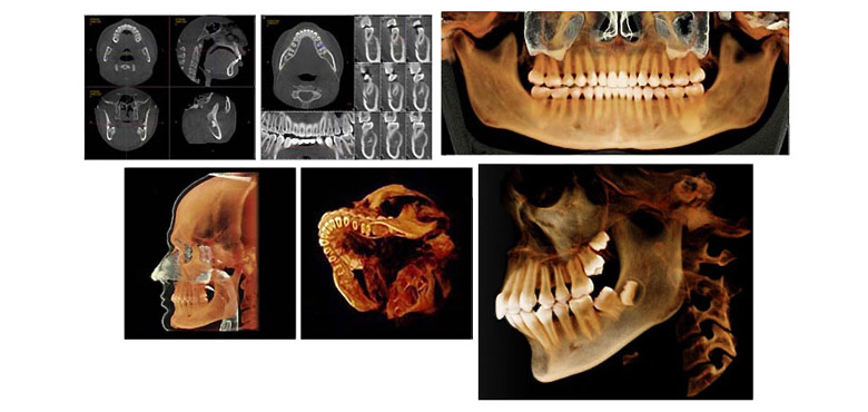 3-D images i-CAT
