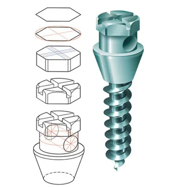 specialty_ortho_anchor