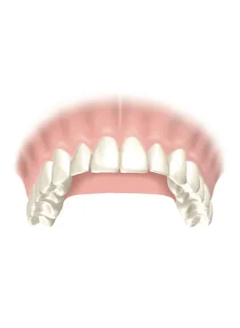 13 upper arch
