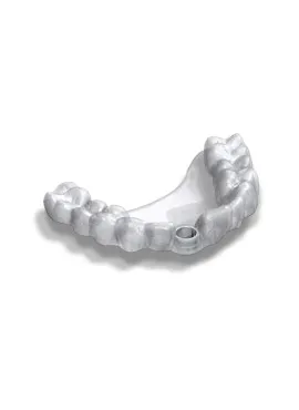 Implant procedure 5