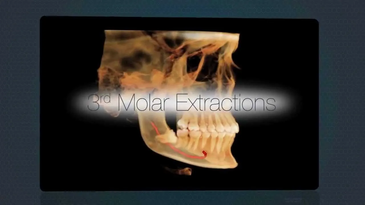 Advanced Dental Implant Imaging in Chicago at ORA Oral Surgery & Implant Studio Video Thumbnail